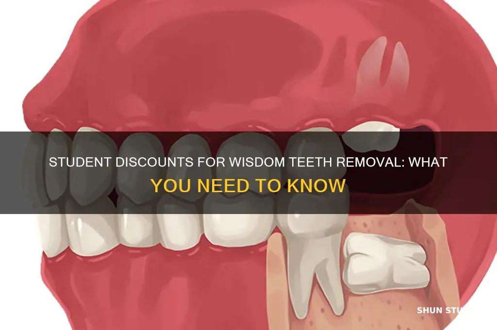can students get discounts on wisdom teeth removal