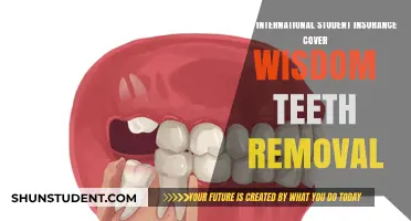 International Student Insurance: Wisdom Teeth Removal Covered?