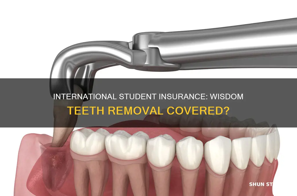 does international student insurance cover wisdom teeth removal