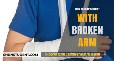 Supporting Students with Broken Arms: Practical Tips for Teachers and Parents