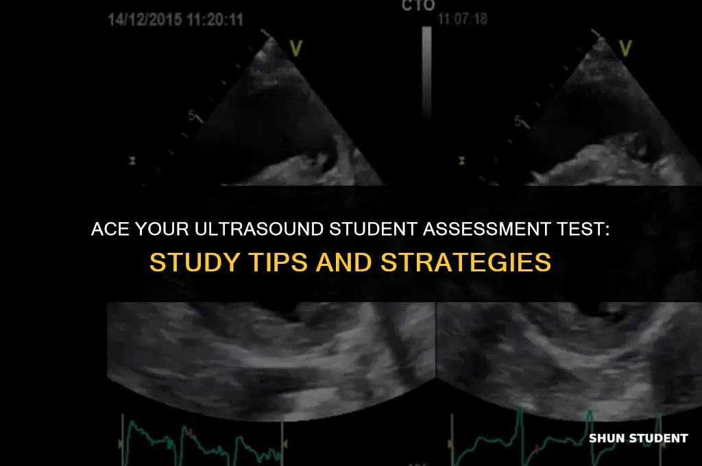 how to study for the ultrasound student assessment test