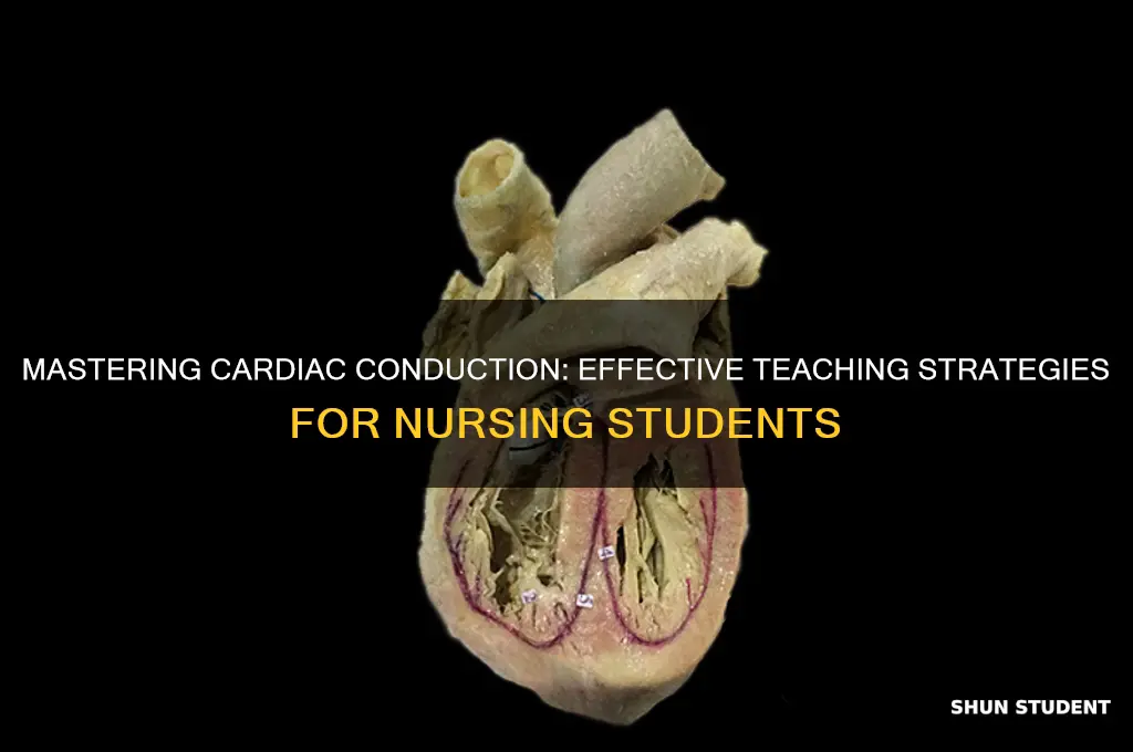 how to teach cardiac conduction system to nursing students