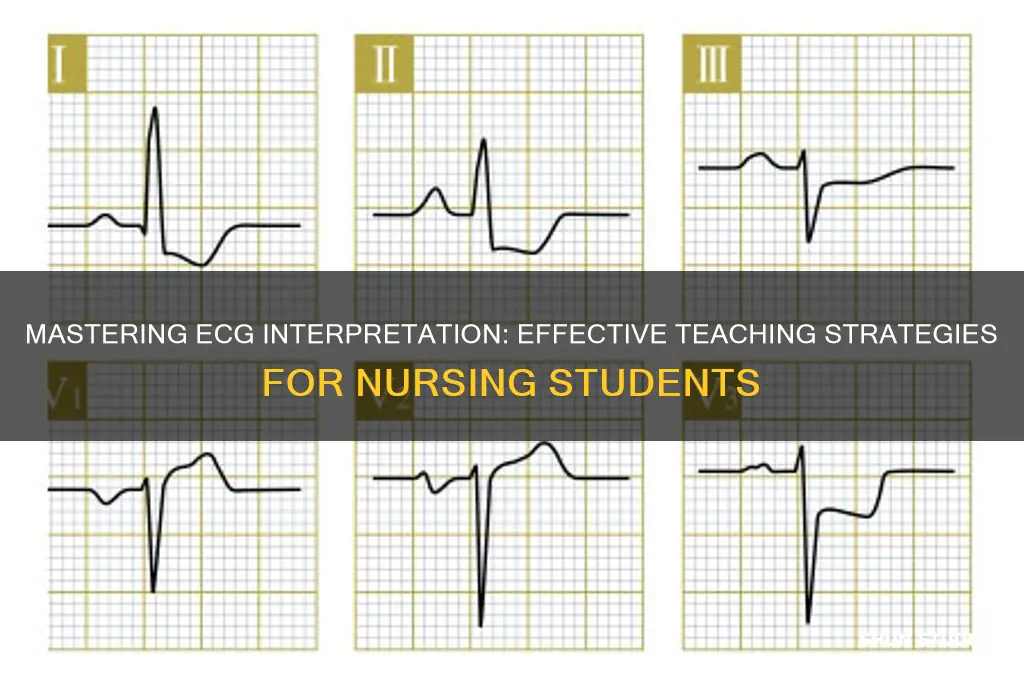 how to teach ecg to nursing students