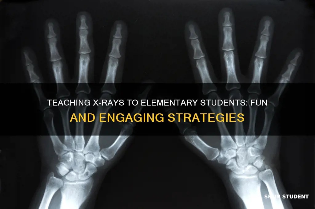 how to teach elementary students about xrays