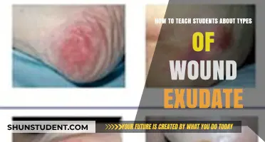Understanding Wound Exudate: A Comprehensive Guide for Student Educators