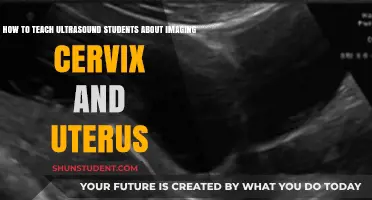 Mastering Cervix and Uterus Imaging: Effective Teaching Strategies for Ultrasound Students