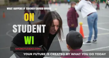 Teacher-Caused Bruises: Legal and Ethical Implications for Educators