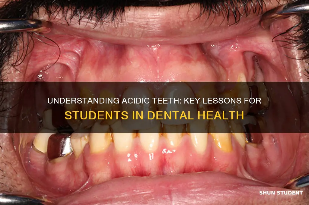 what will students learn from acidic teeth